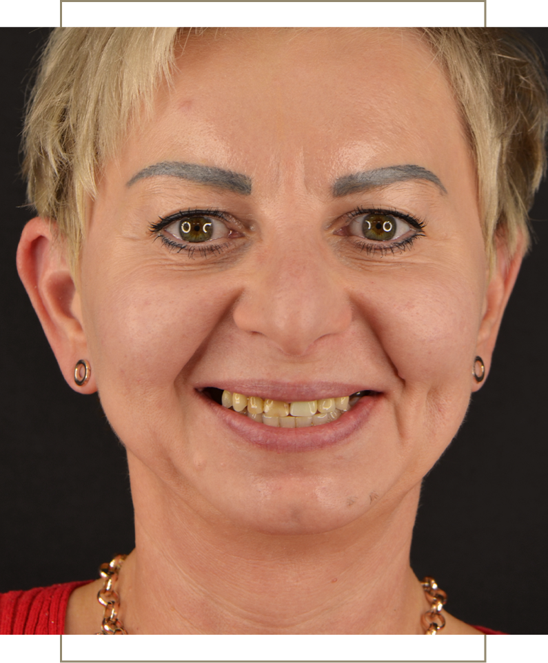 Metamorfoza uśmiechu
