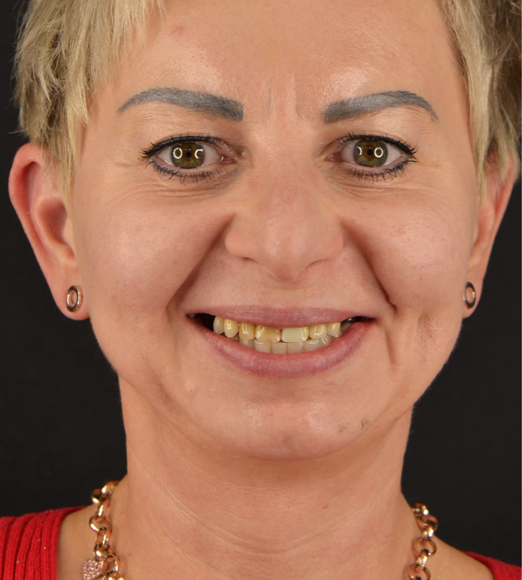 Metamorfoza uśmiechu