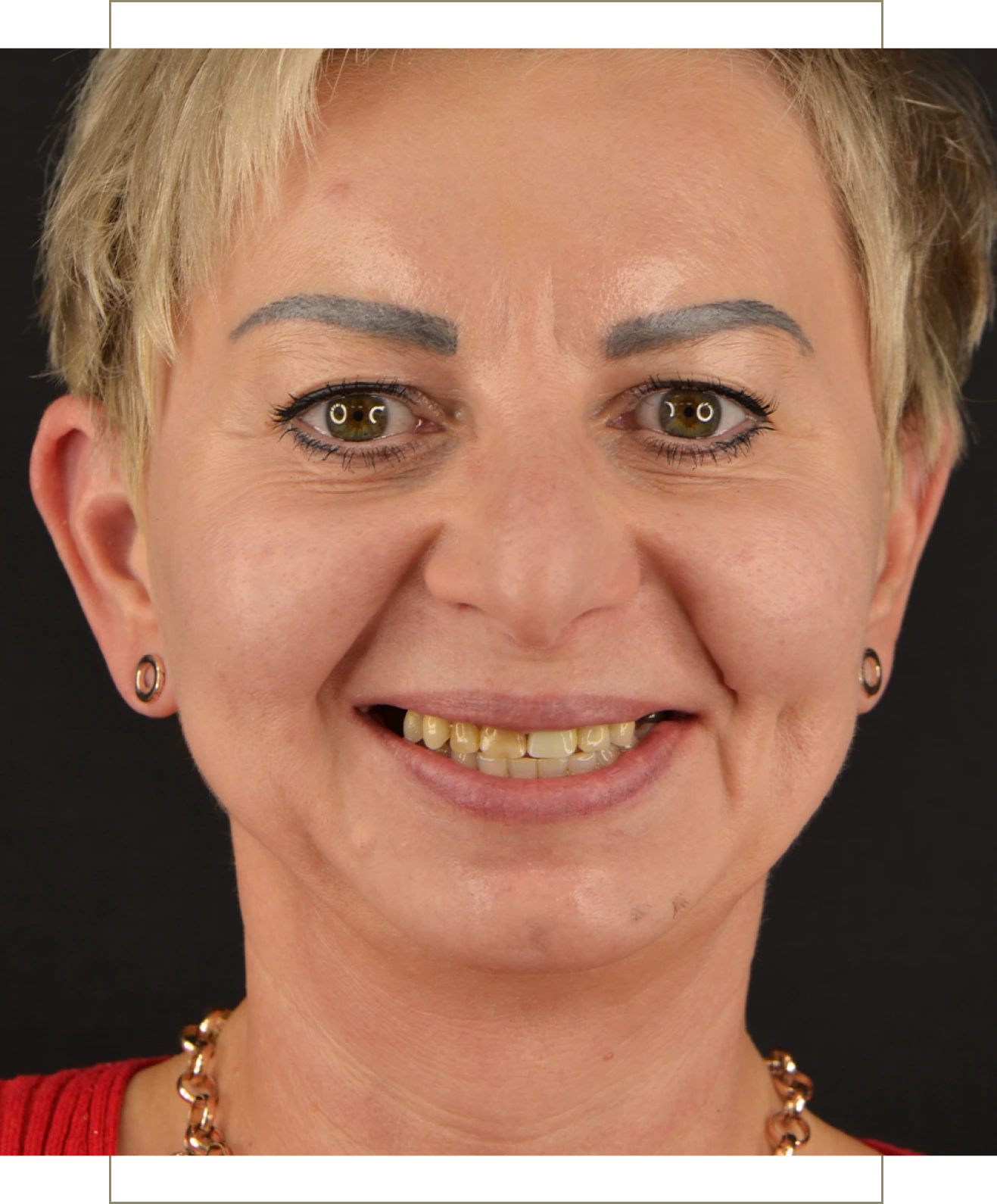 Metamorfoza uśmiechu